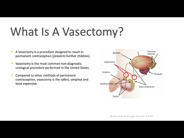 Understanding the Vasectomy Procedure in Auckland: A Patient’s Guide